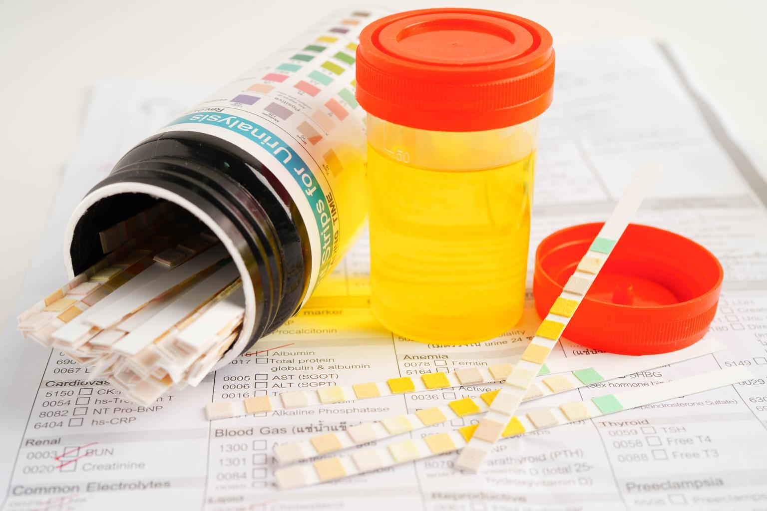 Drug and urinalysis testing